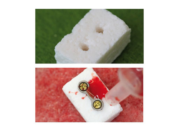ARTOSS náhradní kostní materiál NanoBone® blok