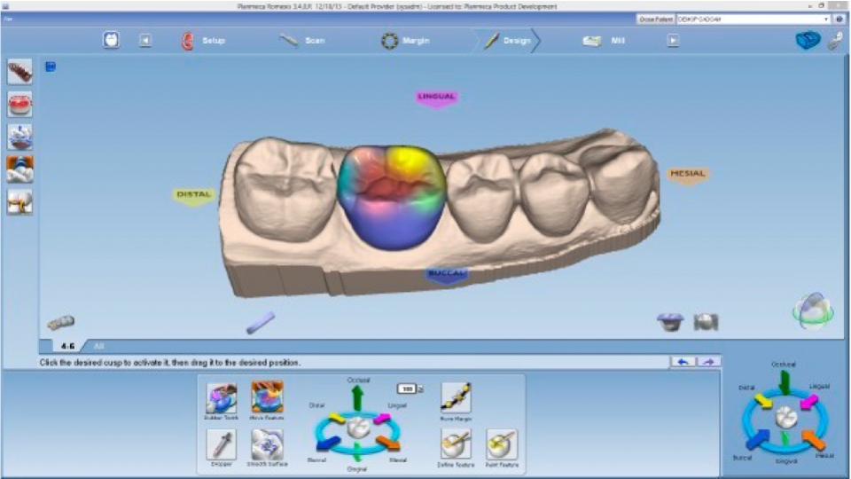 Planmeca CAD/CAM ordinační software PlanCAD Easy