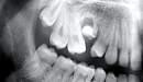 CASTELLINI zubní souprava Skema 8
