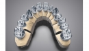 DWOS (Dental Wings Open System)