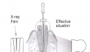 TCM Endo V – endomotor s integrovaným apexlokátorem