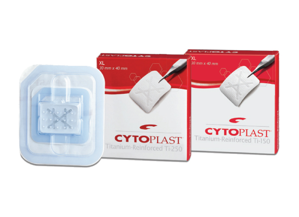 Cytoplast™ Titanium – Reinforced
