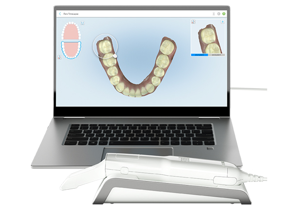 Align Technology intraorální skener iTero Element Flex