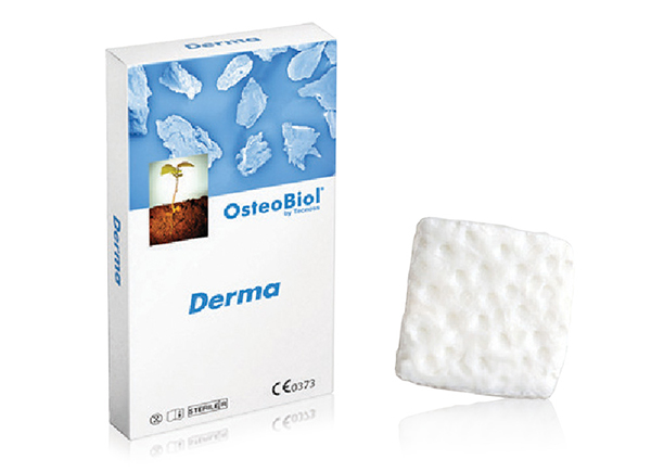 Tecnoss® bariérová membrána OsteoBiol® Derma