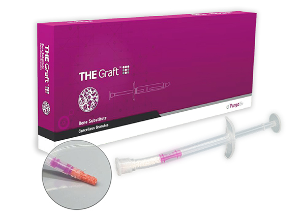 Purgo náhradní kostní materiál THE Graft™ Syringe