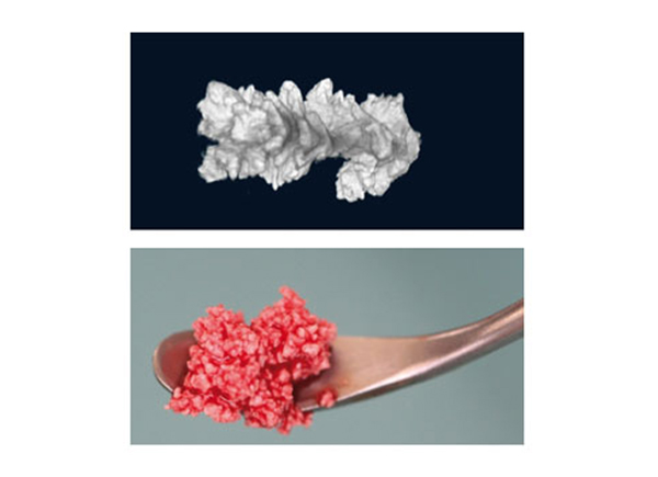 ARTOSS náhradní kostní materiál NanoBone® QD