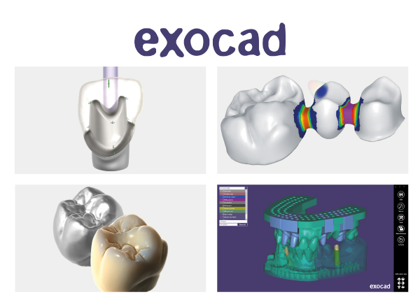 Exocad®