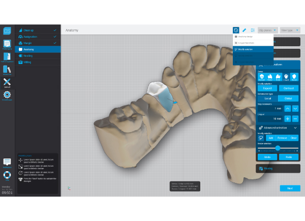 Dental Wings CAD/CAM ordinační software Chairside software