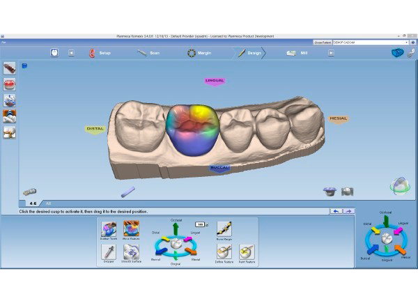 Planmeca CAD/CAM ordinační software PlanCAD Easy