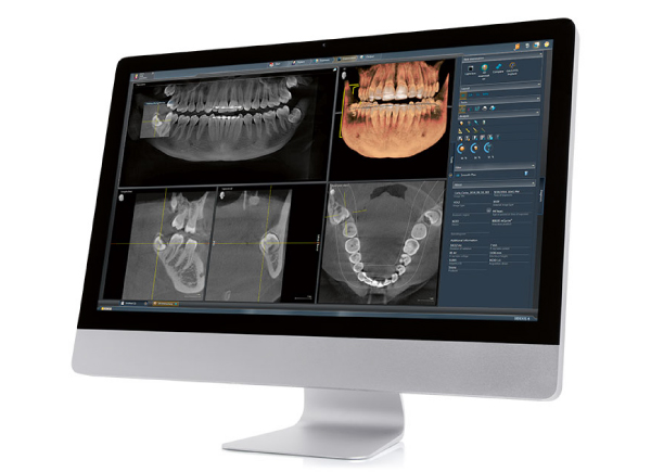 Carestream CAD/CAM ordinační software Imaging software