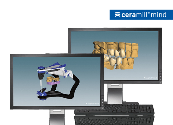 Ceramill Mind