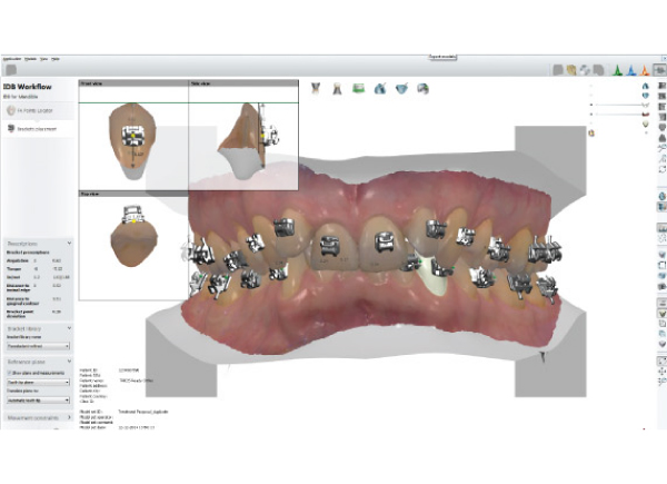 Ortho System