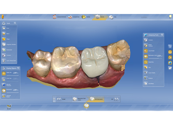 Dentsply Sirona CAD/CAM ordinační software CEREC SW