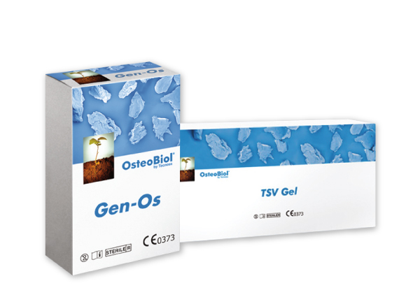Tecnoss náhradní kostní materiál OsteoBiol® TSV Gel v kombinaci s Gen-Os®