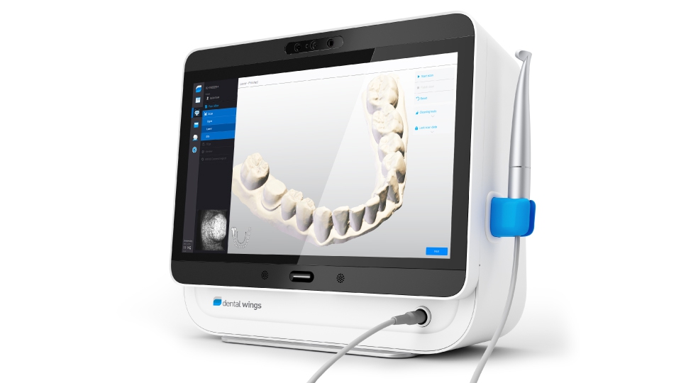 Dental Wings intraorální skener – portable (DWio-P) Dental Wings intraorální skener – portable (DWio-P)