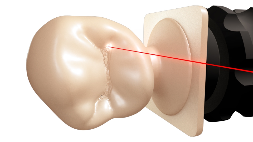 Dental Wings CAD/CAM frézovací jednotka Lasermill