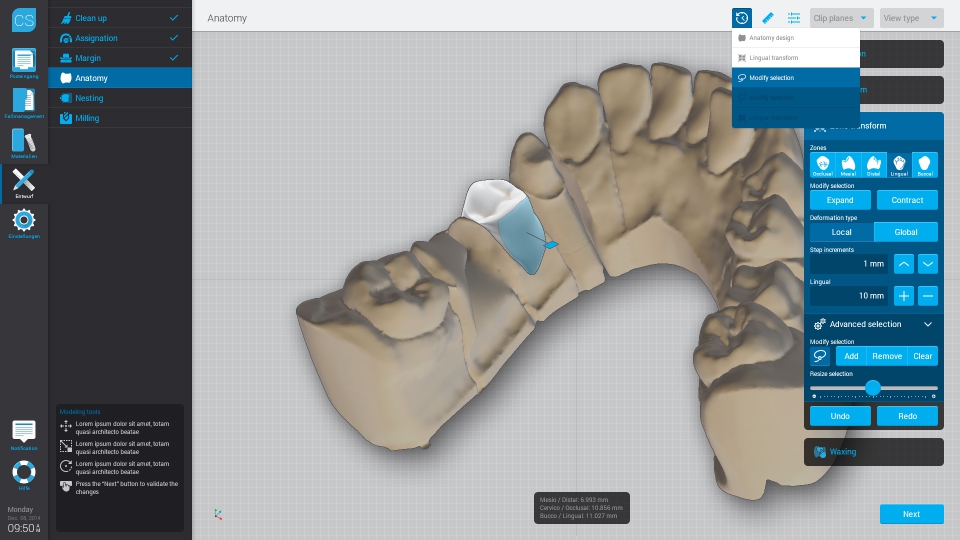 Dental Wings CAD/CAM ordinační software Chairside software