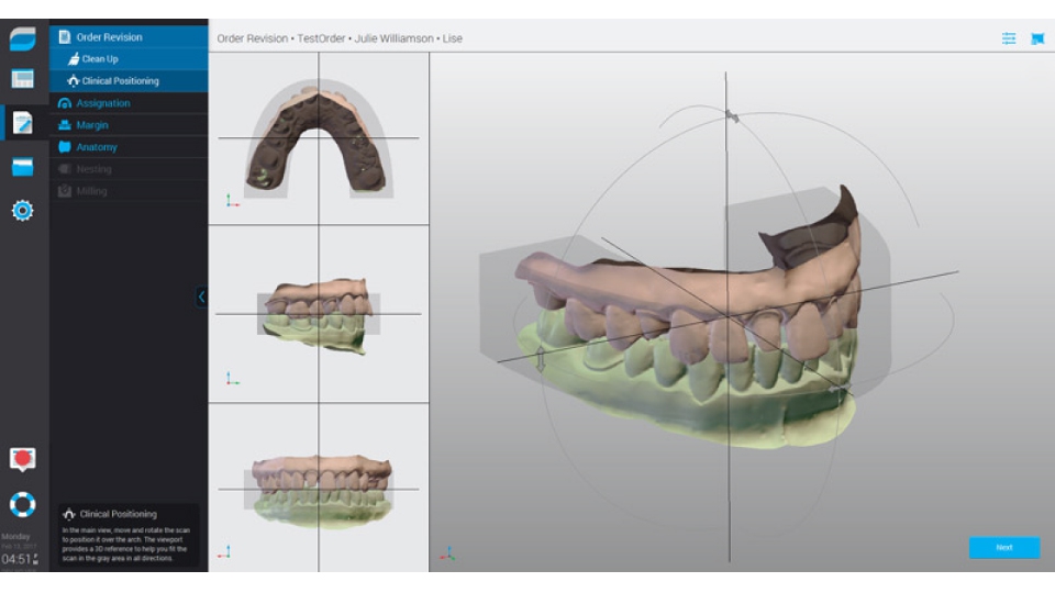 Dental Wings CAD/CAM ordinační software Chairside software