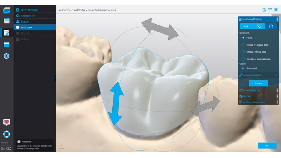 Dental Wings CAD/CAM ordinační software Chairside software