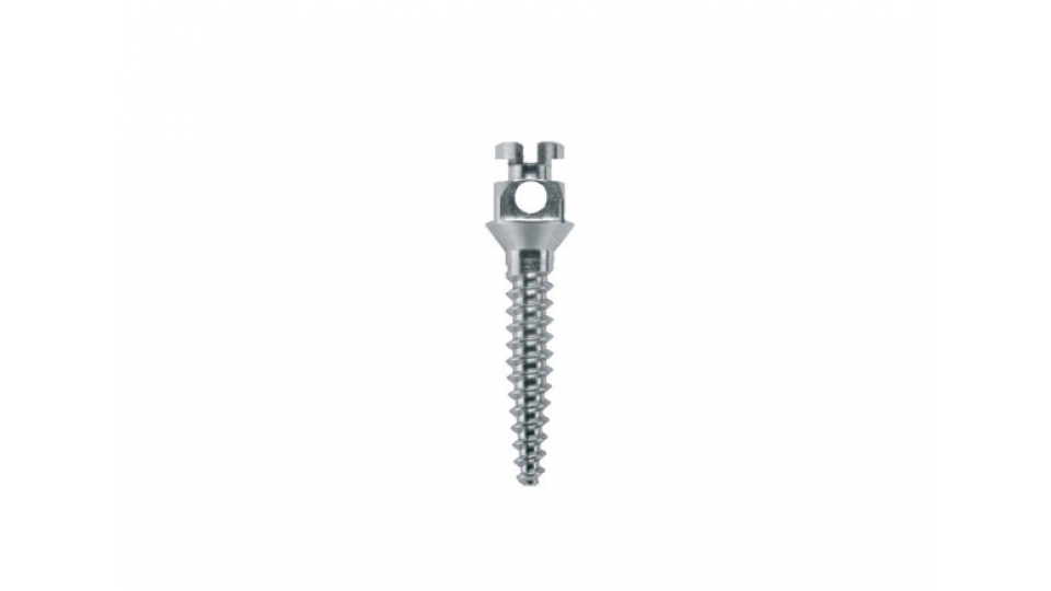 BTLock Slot Implant BTLock Slot Implant