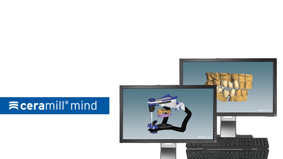 Ceramill Mind Ceramill Mind