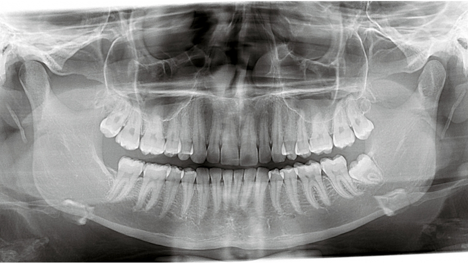 KaVo 3D CBCT rentgen OP 3D Pro