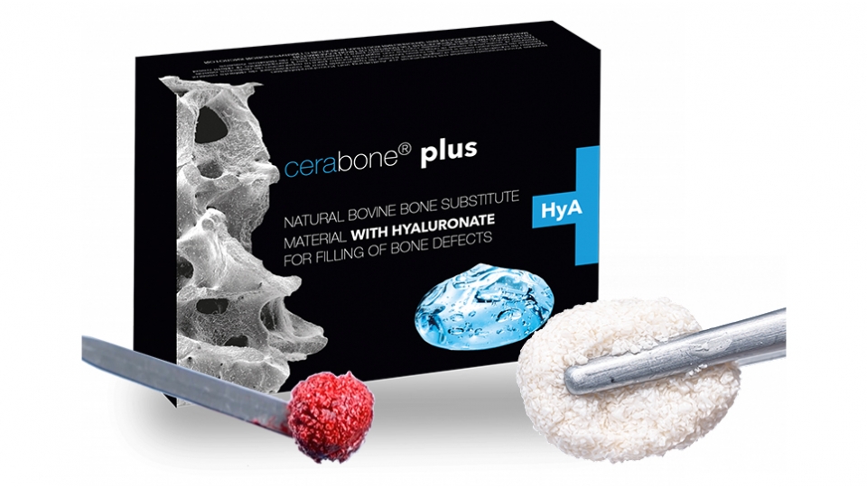botiss náhradní kostní materiál cerabone<sup>®</sup> plus botiss náhradní kostní materiál cerabone<sup>®</sup> plus