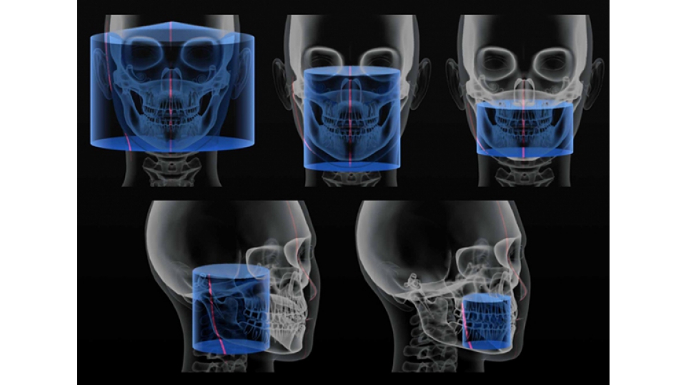 Carestream 3D CBCT rentgen CS 9300 Select / Premium