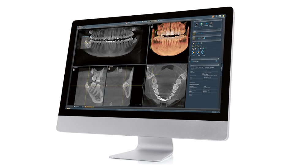 Carestream CAD/CAM ordinační software Imaging software