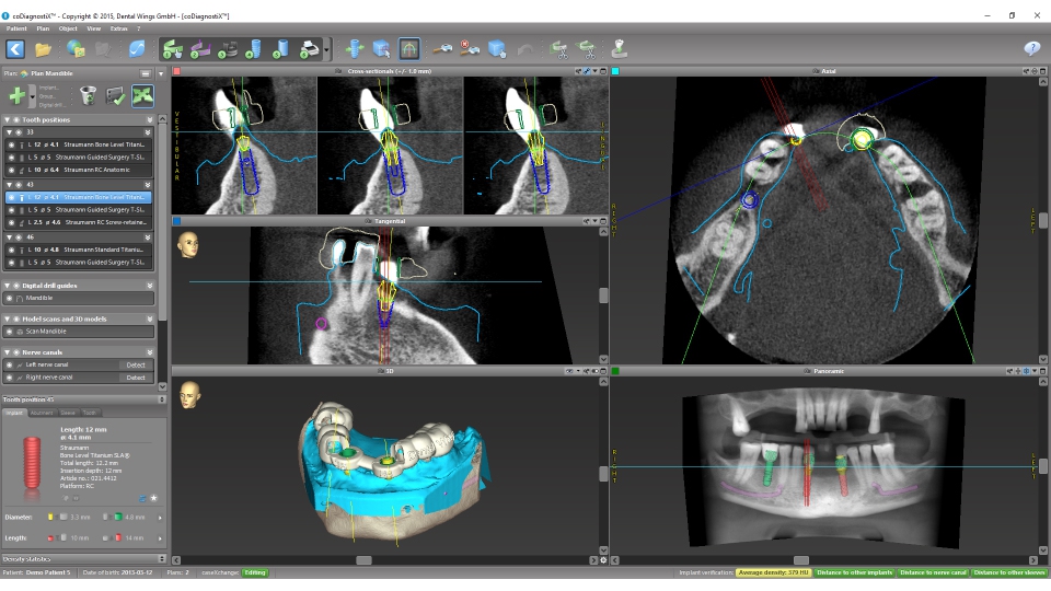 Dental Wings CAD/CAM ordinační software CoDiagnostiX