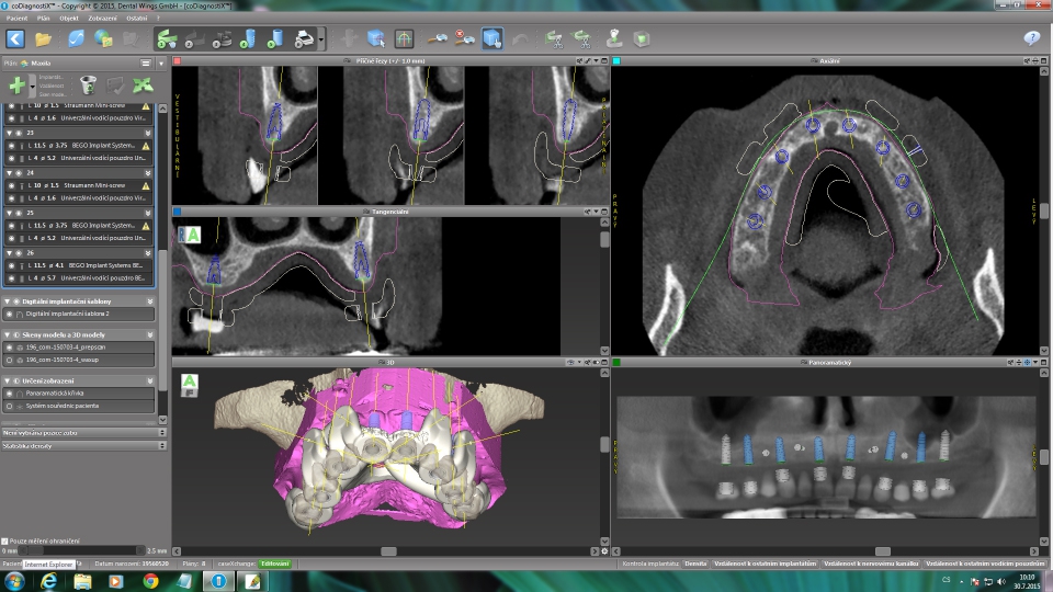 Dental Wings CAD/CAM ordinační software CoDiagnostiX