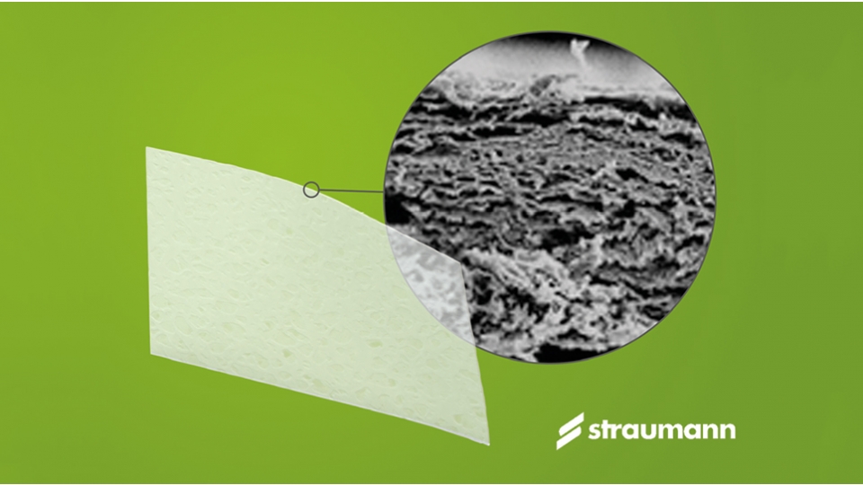 Collagen Matrix bariérová membrána Straumann<sup>®</sup> Membrane Flex™