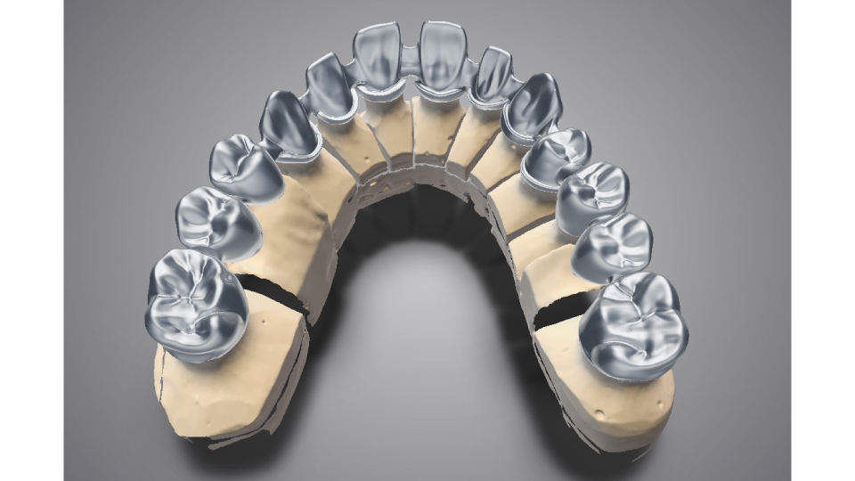 DWOS (Dental Wings Open System)