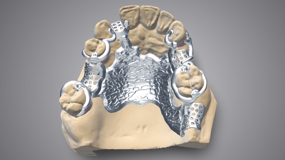 DWOS (Dental Wings Open System)