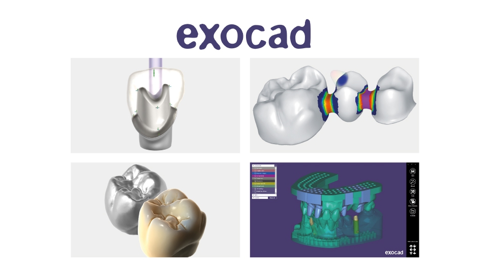 Exocad<sup>®</sup> Exocad<sup>®</sup>