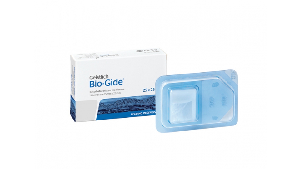 Geistlich Bio-Gide<sup>®</sup> Geistlich Bio-Gide<sup>®</sup> Perio Geistlich Bio-Gide<sup>®</sup> Geistlich Bio-Gide<sup>®</sup> Perio