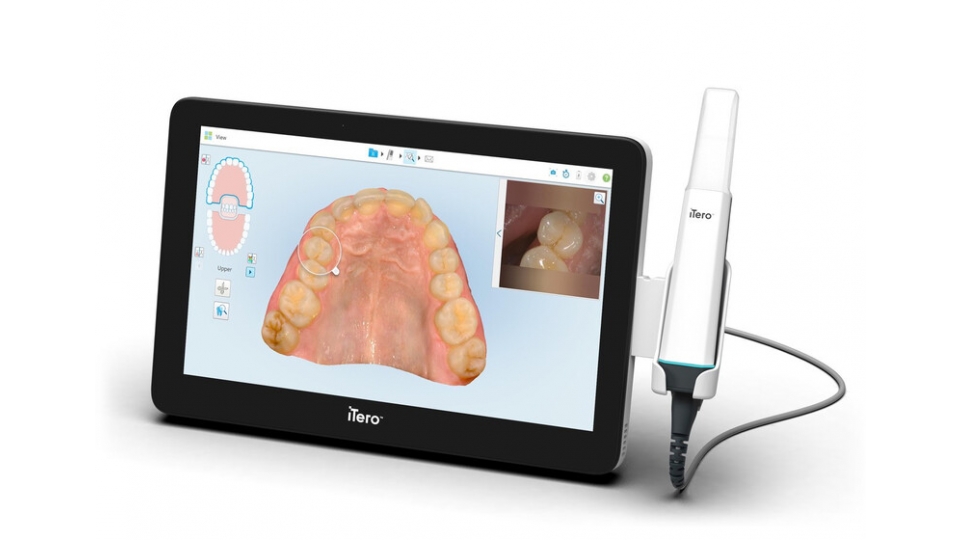 Align Technology intraorální skener iTero Lumina