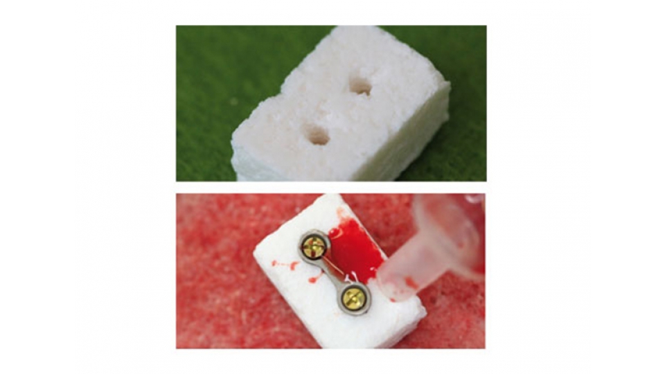 ARTOSS náhradní kostní materiál NanoBone<sup>®</sup> blok