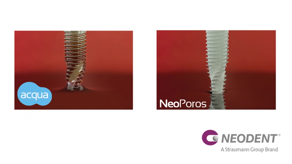 Neodent<sup>®</sup> implantační systém Helix GM