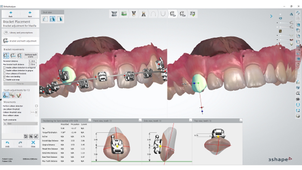 Ortho System