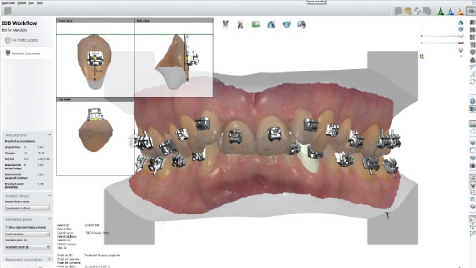 Ortho System