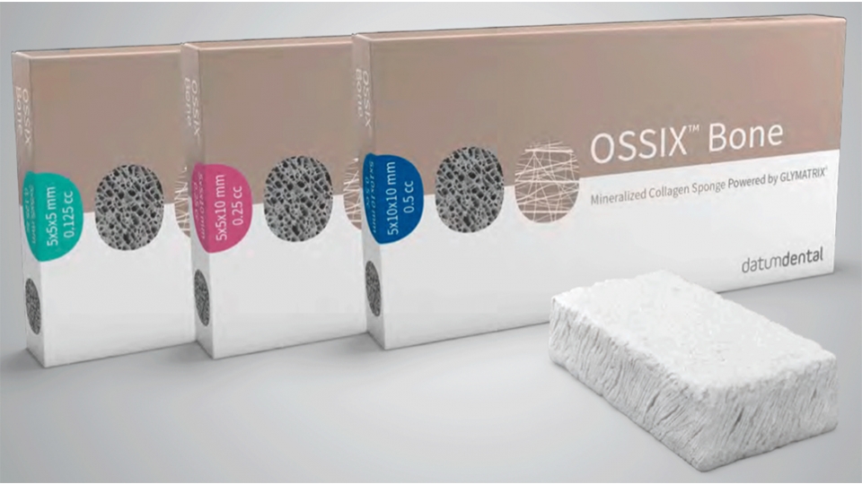 datumdental náhradní kostní materiál OSSIX™ Bone datumdental náhradní kostní materiál OSSIX™ Bone
