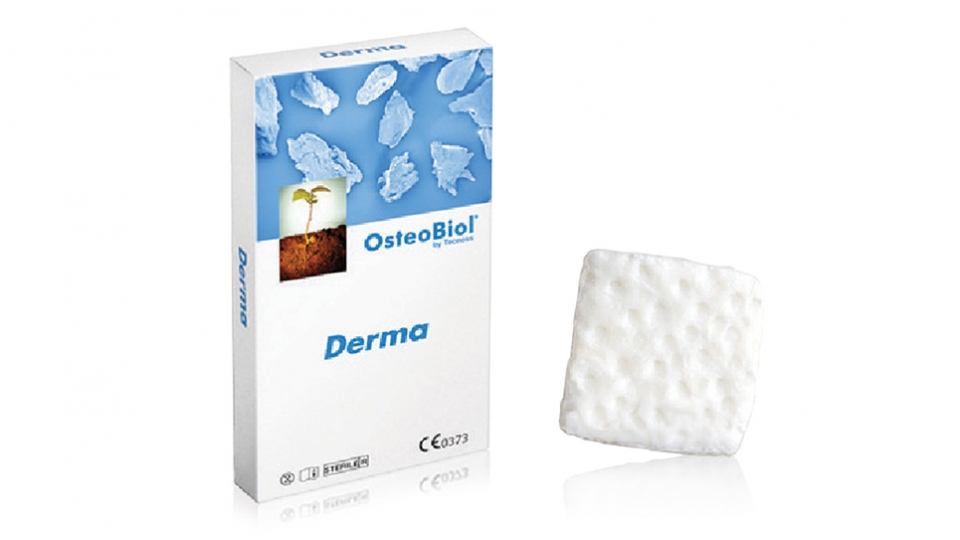 Tecnoss<sup>®</sup> bariérová membrána OsteoBiol<sup>®</sup> Derma