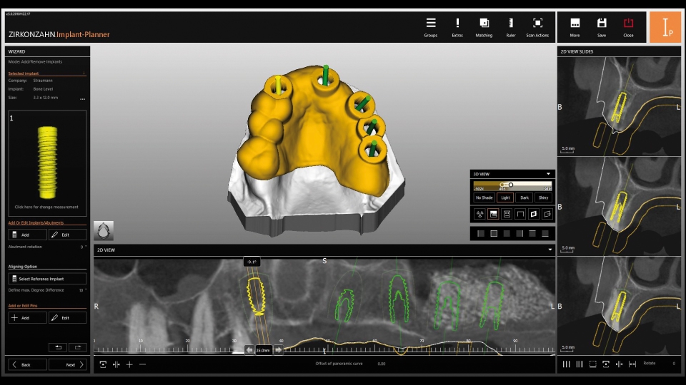 Zirkonzahn CAD/CAM Milling Implant-Planner