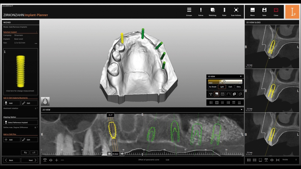 Zirkonzahn CAD/CAM Milling Implant-Planner