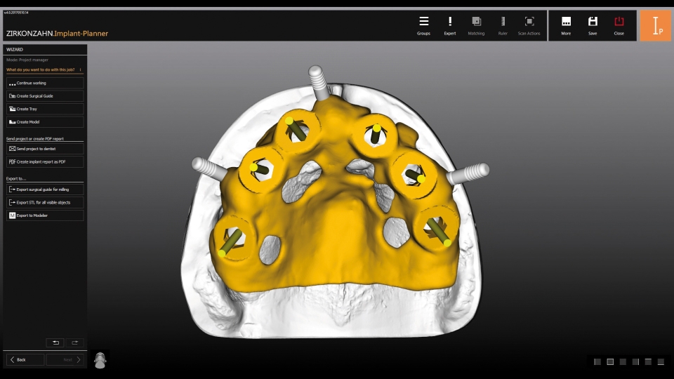 Zirkonzahn CAD/CAM Milling Implant-Planner