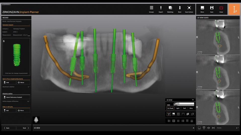 Zirkonzahn CAD/CAM Milling Implant-Planner