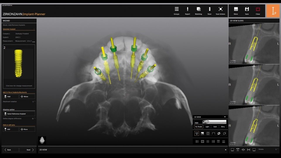 Zirkonzahn CAD/CAM Milling Implant-Planner