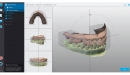 Dental Wings CAD/CAM ordinační software Chairside software