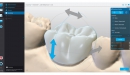Dental Wings CAD/CAM ordinační software Chairside software